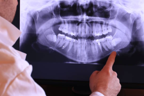 Best Emergency Dental Care for Broken or Chipped Teeth in Kenilworth, PA
